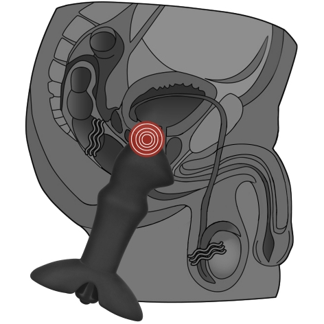 Stimulateur de Prostate Vibrant - Anal Indulgence - Silicone Prostate Stud Anal Indulgence Sensations plus